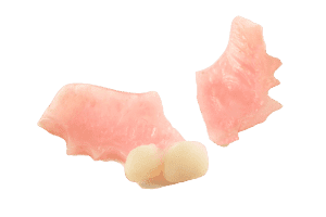 denture repair